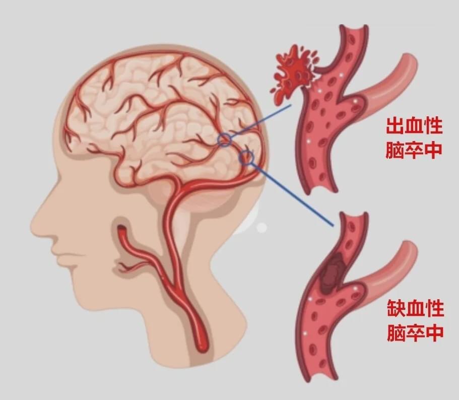 夏风如歌 第3页