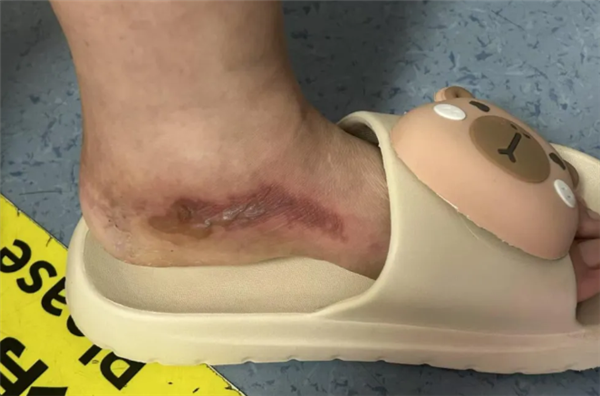 女子往鞋里倒敌敌畏女子往鞋里倒敌敌畏，背后的原因与理解