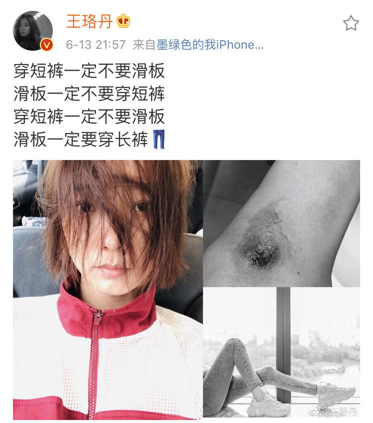 鹿晗膝盖疑似流血鹿晗膝盖疑似受伤，引发粉丝担忧