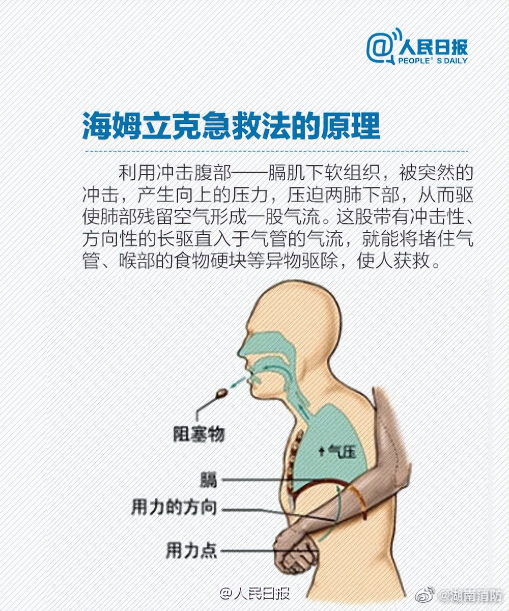 女孩吸食奶茶时被珍珠噎住 众人施救女孩遭遇珍珠奶茶危机，众人携手施救的温暖瞬间