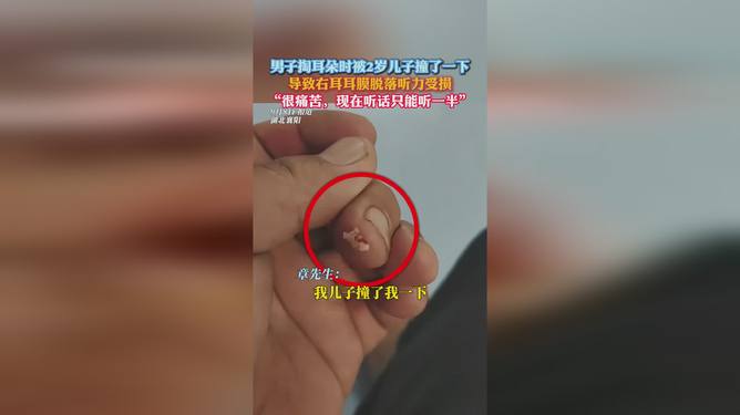 掏耳被撞致鼓膜脱落掏耳被撞致鼓膜脱落，深度解析与应对指南