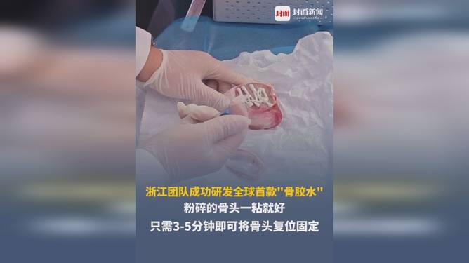 全球首款骨胶水全球首款骨胶水可能是指某种特定类型的产品，但据我所知，目前市场上存在一些骨胶水的相关产品。